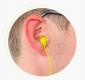 Pack protections auditives EarTech Access avec filtre S-15Ai